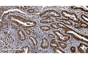 IHC analysis of Ku70 using anti-Ku70 antibody (ABIN7602790).