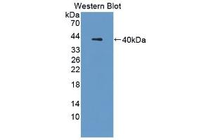 Detection of Recombinant CTSL, Mouse using Polyclonal Antibody to Cathepsin L (CTSL) (Cathepsin L 抗体  (AA 18-113))