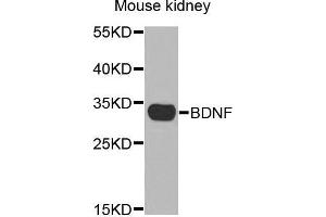 Western Blotting (WB) image for anti-Brain-Derived Neurotrophic Factor (BDNF) (AA 20-247) antibody (ABIN3021893) (BDNF 抗体  (AA 20-247))