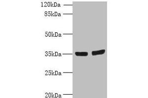 Western blot All lanes: OSR2 antibody at 7 μg/mL Lane 1: Jurkat whole cell lysate Lane 2: Hela whole cell lysate Secondary Goat polyclonal to rabbit IgG at 1/10000 dilution Predicted band size: 36, 31, 49 kDa Observed band size: 36 kDa (OSR2 抗体  (AA 101-276))