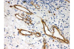 Immunohistochemistry (Paraffin-embedded Sections) (IHC (p)) image for anti-Heparan Sulfate Proteoglycan 2 (HSPG2) (AA 524-701) antibody (ABIN3042466) (HSPG2 抗体  (AA 524-701))