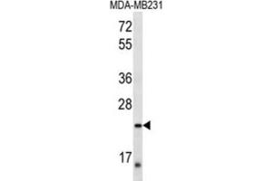 Western Blotting (WB) image for anti-Peroxisomal Biogenesis Factor 11 alpha (PEX11A) antibody (ABIN2997181) (PEX11A 抗体)