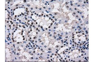 Immunohistochemical staining of paraffin-embedded endometrium tissue using anti-TTLL12mouse monoclonal antibody. (TTLL12 抗体)