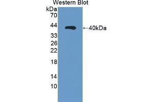 Detection of Recombinant NR3C1, Human using Polyclonal Antibody to Retinaldehyde Binding Protein 1 (RLBP1) (RLBP1 抗体)