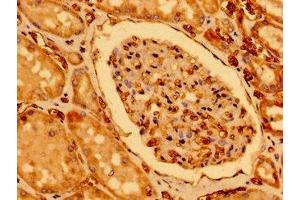 Immunohistochemistry of paraffin-embedded human kidney tissue using ABIN7147612 at dilution of 1:100 (CHDH 抗体  (AA 30-223))