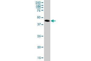 Western Blotting (WB) image for anti-ATPase, H+ Transporting, Lysosomal 42kDa, V1 Subunit C2 (ATP6V1C2) (AA 1-381) antibody (ABIN531407)