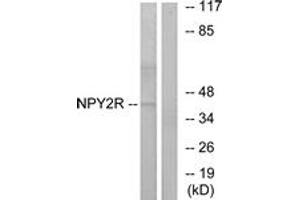 Western blot analysis of extracts from HepG2 cells, using NPY2R Antibody. (NPY2R 抗体  (AA 1-50))