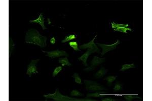 Immunofluorescence (IF) image for anti-Neurotrophic tyrosine Kinase, Receptor, Type 3 (NTRK3) (AA 41-160) antibody (ABIN518453)