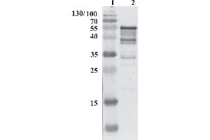 Western Blot testing of anti-HCV NS5B protein using chimeric anti-HCV NS5B antibody 9A2.