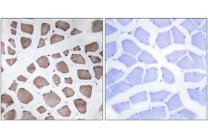 Immunohistochemistry analysis of paraffin-embedded human skeletal muscle tissue, using MRPS18C Antibody. (MRPS18C 抗体  (AA 71-120))