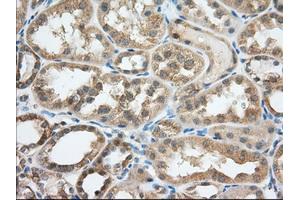 Image no. 1 for anti-Transforming, Acidic Coiled-Coil Containing Protein 3 (TACC3) antibody (ABIN1498098) (TACC3 抗体)