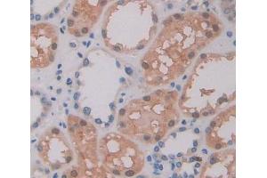 Immunohistochemistry (IHC) image for anti-ATP-Binding Cassette, Sub-Family A (ABC1), Member 9 (ABCA9) (AA 1423-1590) antibody (ABIN7445000)