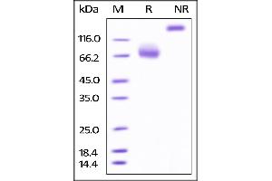 SDS-PAGE (SDS) image for CD80 (CD80) (AA 35-242) (Active) protein (Fc Tag,AVI tag,Biotin) (ABIN4949000)