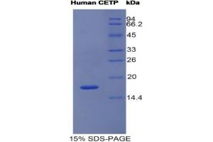SDS-PAGE analysis of Human CETP Protein. (CETP 蛋白)