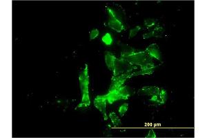 Immunofluorescence of monoclonal antibody to CENPK on HepG2 cell. (CENPK 抗体  (AA 1-269))