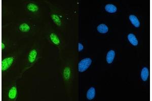 IF analysis of HAUSP/USP7 using anti-HAUSP/USP7 antibody (ABIN5693267). (USP7 抗体  (AA 258-483))
