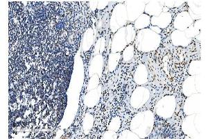 IHC analysis of NRF1 using anti-NRF1 antibody (ABIN7600874).
