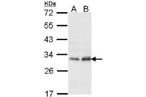 WB Image Sample (30 ug of whole cell lysate) A: Hela B: Hep G2 , 12% SDS PAGE antibody diluted at 1:1000 (PMM2 抗体)