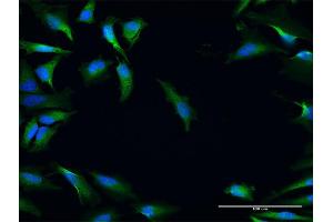 Immunofluorescence of purified MaxPab antibody to NRBF2 on HeLa cell. (NRBF2 抗体  (AA 1-287))