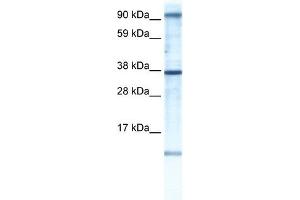 AKAP7 antibody used at 1 ug/ml to detect target protein. (AKAP7 抗体)