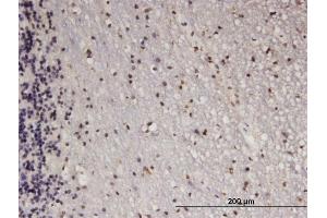 Immunoperoxidase of monoclonal antibody to ATF5 on formalin-fixed paraffin-embedded human cerebellum. (ATF5 抗体  (AA 101-200))
