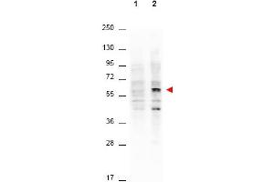 Western Blotting (WB) image for anti-V-Akt Murine Thymoma Viral Oncogene Homolog 1 (AKT1) (Thr308) antibody (ABIN400786)
