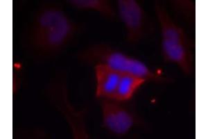 Image no. 1 for anti-Protein Phosphatase 1, Regulatory (Inhibitor) Subunit 1B (PPP1R1B) (pThr75) antibody (ABIN401600) (DARPP32 抗体  (pThr75))