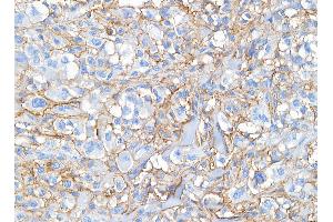 Immunohistochemistry (IHC) image for anti-CD44 (CD44) (AA 692-742) antibody (ABIN7453578) (CD44 抗体  (AA 692-742))