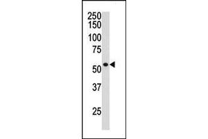 The anti-HDAC1 Pab (ABIN387945 and ABIN2844611) is used in Western blot to detect HDAC1 in ZR-75-1 cell lysate. (HDAC1 抗体  (C-Term))