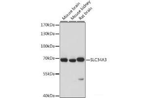 Western blot analysis of extracts of various cell lines using SLC34A3 Polyclonal Antibody at dilution of 1:1000. (SLC34A3 抗体)