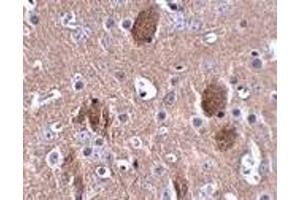 Immunohistochemistry of CDIP in mouse brain tissue with CDIP antibody at 2. (CDIP1 抗体  (Center))