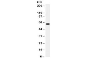 Western blot testing of HeLa cell lysate with HSP60 antibody (clone LK2). (HSPD1 抗体)