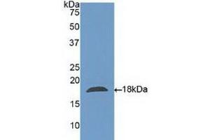 Detection of Recombinant CLC, Human using Polyclonal Antibody to Charcot Leyden Crystal Protein (CLC) (Galectin 10 抗体  (AA 2-142))