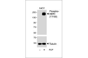 Western blot analysis of lysates from A431 cell line, untreated or treated with EGF, 100 ng/mL, using Phospho-HER4 Antibody (upper) or tubulin (lower). (ERBB4 抗体  (pTyr1188))