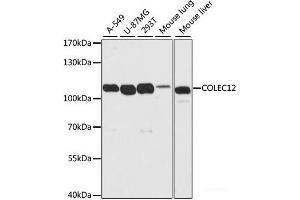 Western blot analysis of extracts of various cell lines using COLEC12 Polyclonal Antibody at dilution of 1:2000. (COLEC12 抗体)