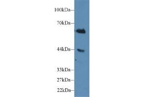 Detection of CD15 in Human Jurkat cell lysate using Polyclonal Antibody to Cluster Of Differentiation 15 (CD15) (CD15 抗体  (AA 144-389))