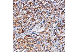 IHC analysis of SLC9A3R2 using anti-SLC9A3R2 antibody (ABIN7599271).