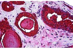 Anti-KLK3 / PSA antibody IHC staining of human prostate. (Prostate Specific Antigen 抗体)