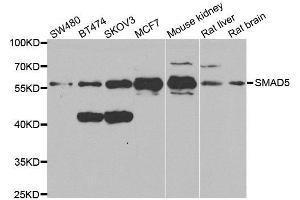 Western blot analysis of extracts of various cell lines, using SMAD5 antibody. (SMAD5 抗体  (AA 186-465))