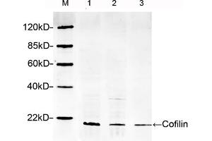 Lane 1: Hela lysateLane 2: HEK293 lysateLane 3: NIH/3T3 lysateWestern blot analysis cell lysates using 1 µg/mL Rabbit Anti-Cofilin Polyclonal Antibody (ABIN398791) The signal was developed with IRDyeTM 800 Conjugated Goat Anti-Rabbit IgG. (Cofilin 抗体  (AA 100-150))
