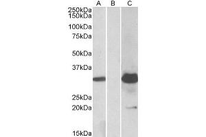 HEK293 lysate (10ug protein in RIPA buffer) overexpressing Human KCTD11 with DYKDDDDK tag probed with ABIN2563535 (1. (KCTD11 抗体  (Internal Region))