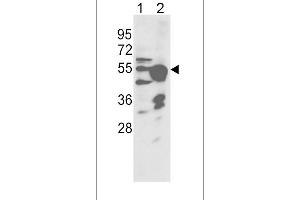 Western blot analysis of CYP2R1 Antibody (Center) (ABIN392380 and ABIN2842012) in NCI- cell line(lane 1) and mouse liver tissue(lane 2) lysates (35 μg/lane). (CYP2R1 抗体  (AA 152-180))