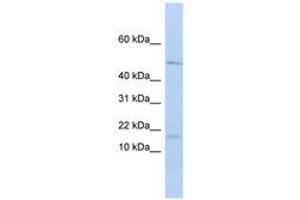 Image no. 1 for anti-Pre-B Lymphocyte 1 (VPREB1) (AA 36-85) antibody (ABIN6740759) (VPREB1 抗体  (AA 36-85))