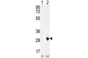Western Blotting (WB) image for anti-Chorionic Somatomammotropin Hormone 1 (Placental Lactogen) (CSH1) (AA 180-208), (C-Term) antibody (ABIN954170)