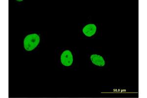 Immunofluorescence of monoclonal antibody to NOL4 on HeLa cell. (NOL4 抗体  (AA 425-524))