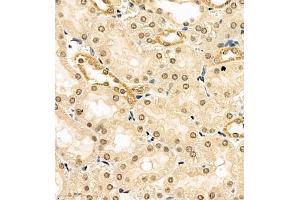 Immunohistochemistry of paraffin embedded rat kidney using HES3 (ABIN7074159) at dilution of 1:1000 (400x lens) (HES3 抗体)