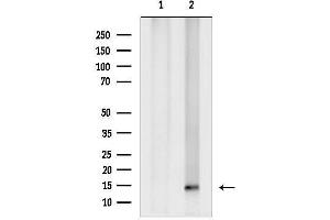 anti-Small Ubiquitin Related Modifier 4 (SUMO4) (Internal Region) antibody