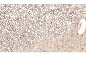 Immunohistochemistry (IHC) image for anti-Apolipoprotein E (APOE) (AA 19-168) antibody (ABIN7427423)