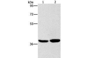 Western Blot analysis of Human fetal brain tissue and 231 cell using CAB39L Polyclonal Antibody at dilution of 1:400 (CAB39L 抗体)