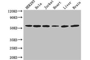 Western Blot Positive WB detected in: HEK293 whole cell lysate, Hela whole cell lysate, Jurkat whole cell lysate, Mouse heart tissue, Mouse liver tissue, Mouse brain tissue All lanes: ARIH2 antibody at 3 μg/mL Secondary Goat polyclonal to rabbit IgG at 1/50000 dilution Predicted band size: 58 kDa Observed band size: 58 kDa (ARIH2 抗体  (AA 43-360))